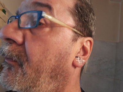 Orecchio sinistro